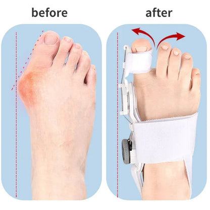 Toe Straightener Bunion Corrector